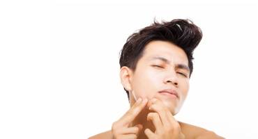 Vette, onzuivere acne huid
